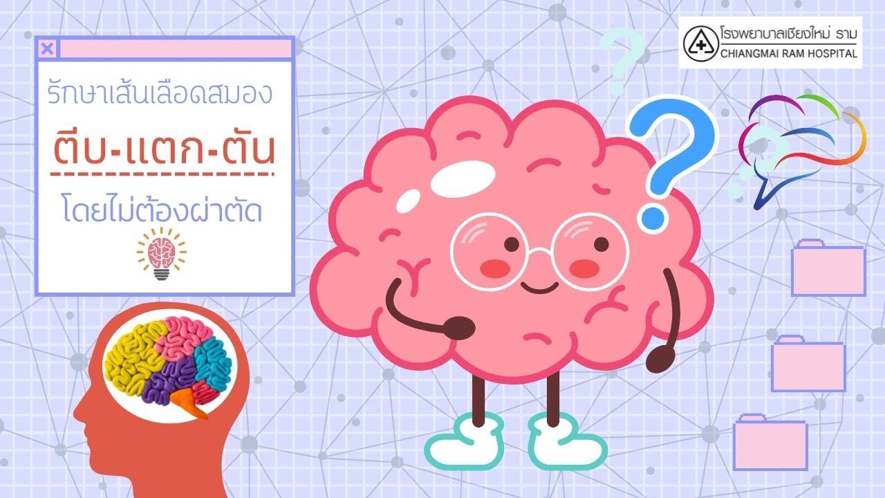 รักษาโรคหลอดเลือดสมอง ตีบ-แตก-ตัน