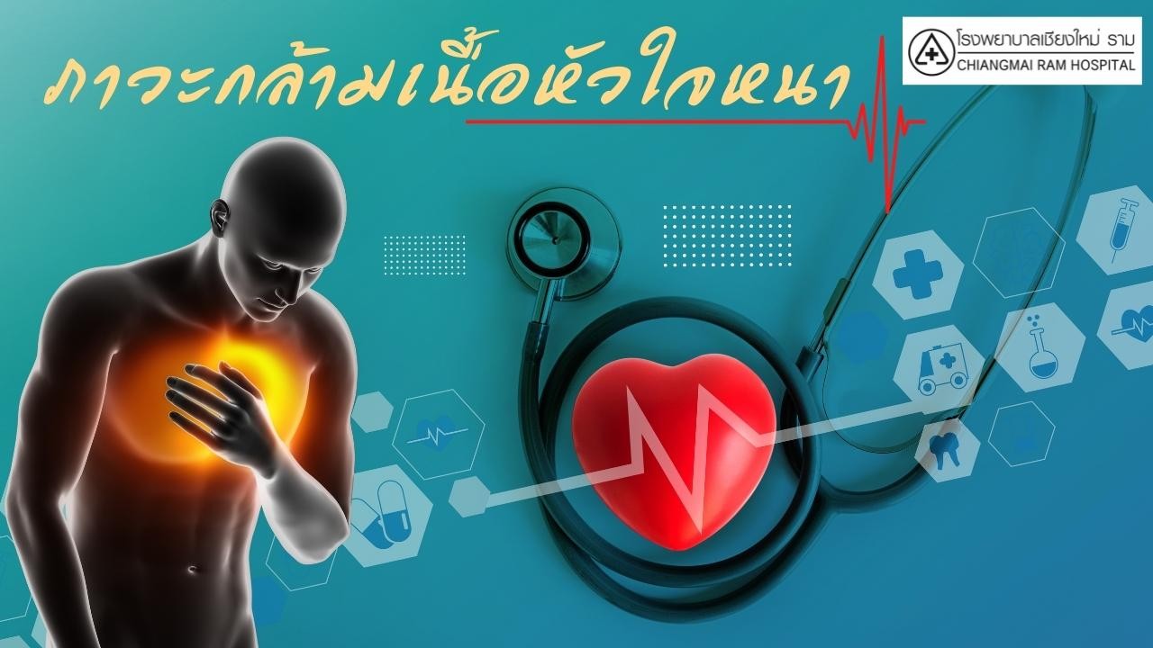 ภาวะกล้ามเนื้อหัวใจหนา