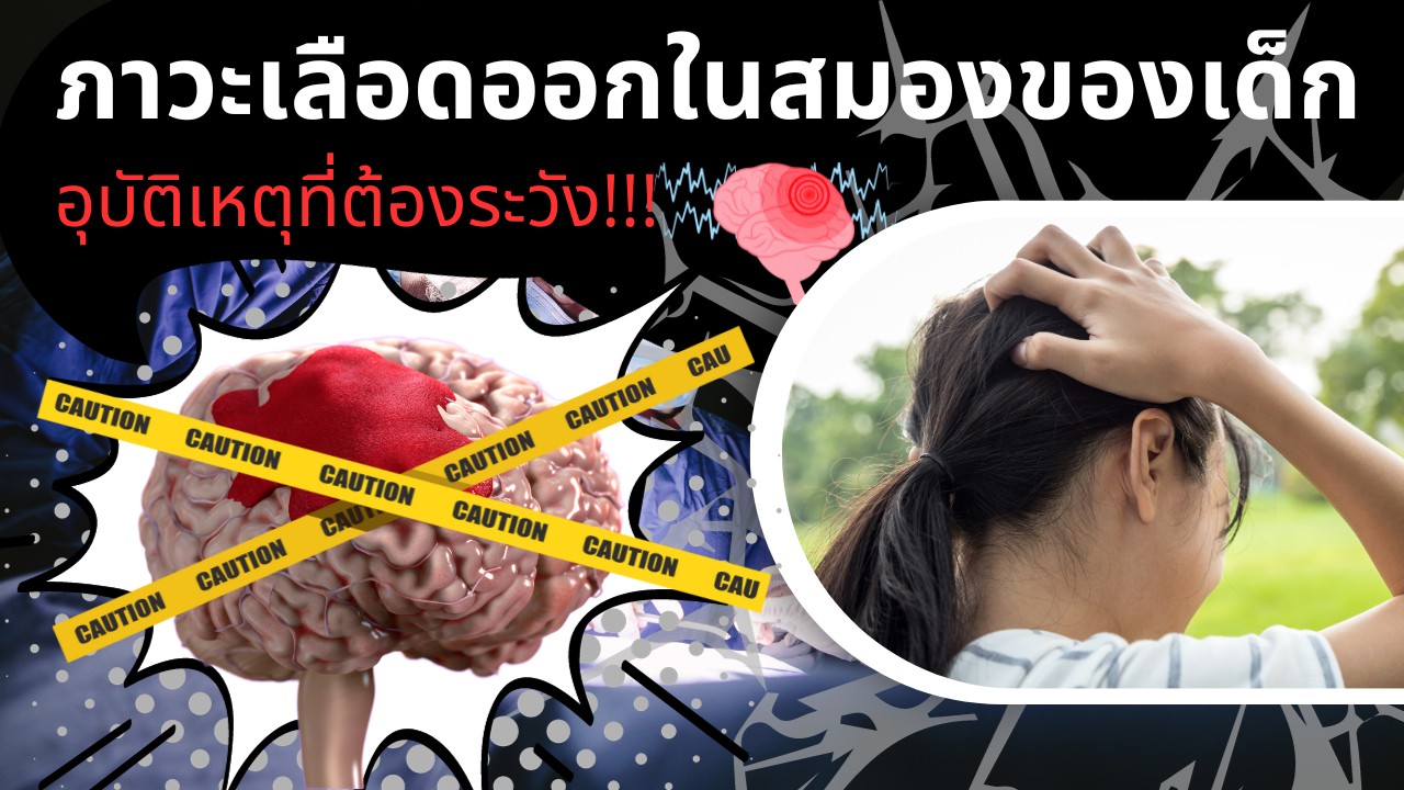 ภาวะเลือดออกในสมองของเด็ก