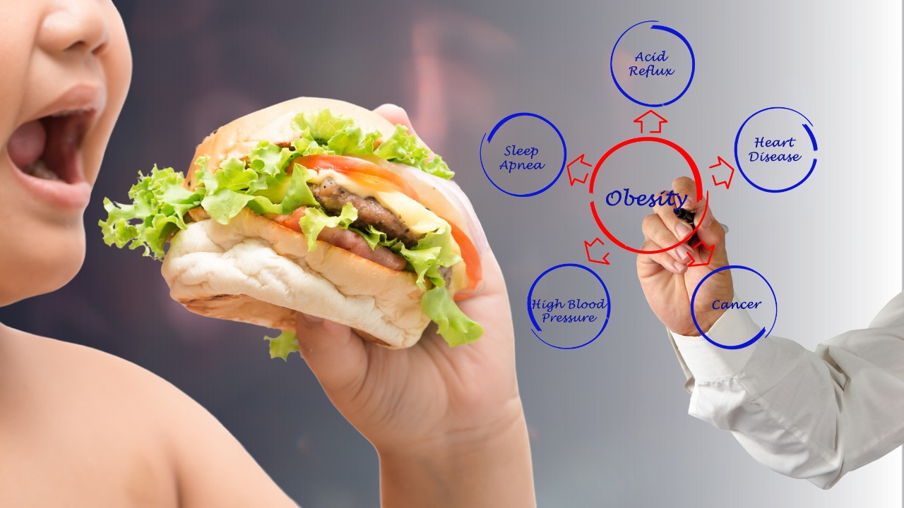 Obesity